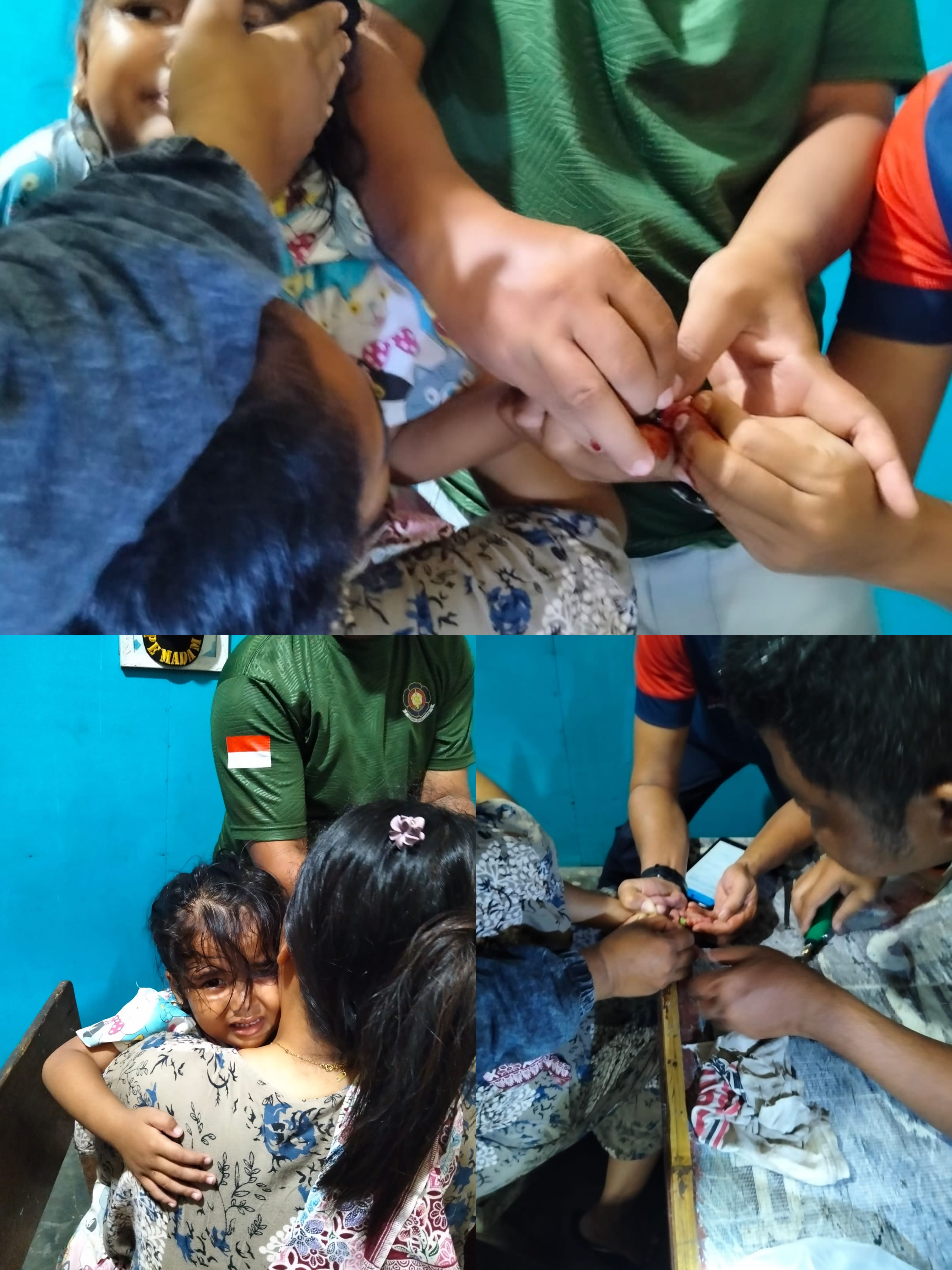 EVAKUASI PELEPASAN CINCIN